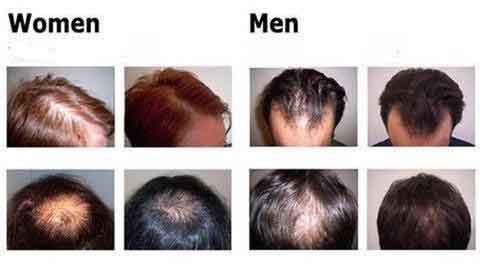 Organic Hair Growth Essence - Mabenir