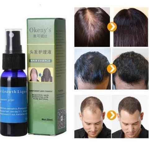Organic Hair Growth Essence - Mabenir